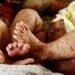 দেশে হামের উপসর্গে আরও ৮ শিশুর মৃত্যু